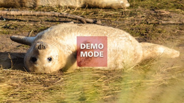 US vs HPV: HPV Prevention Webinars 2024