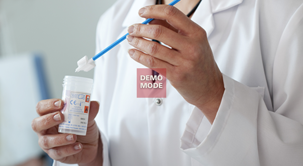 Improving cervical screening take-up